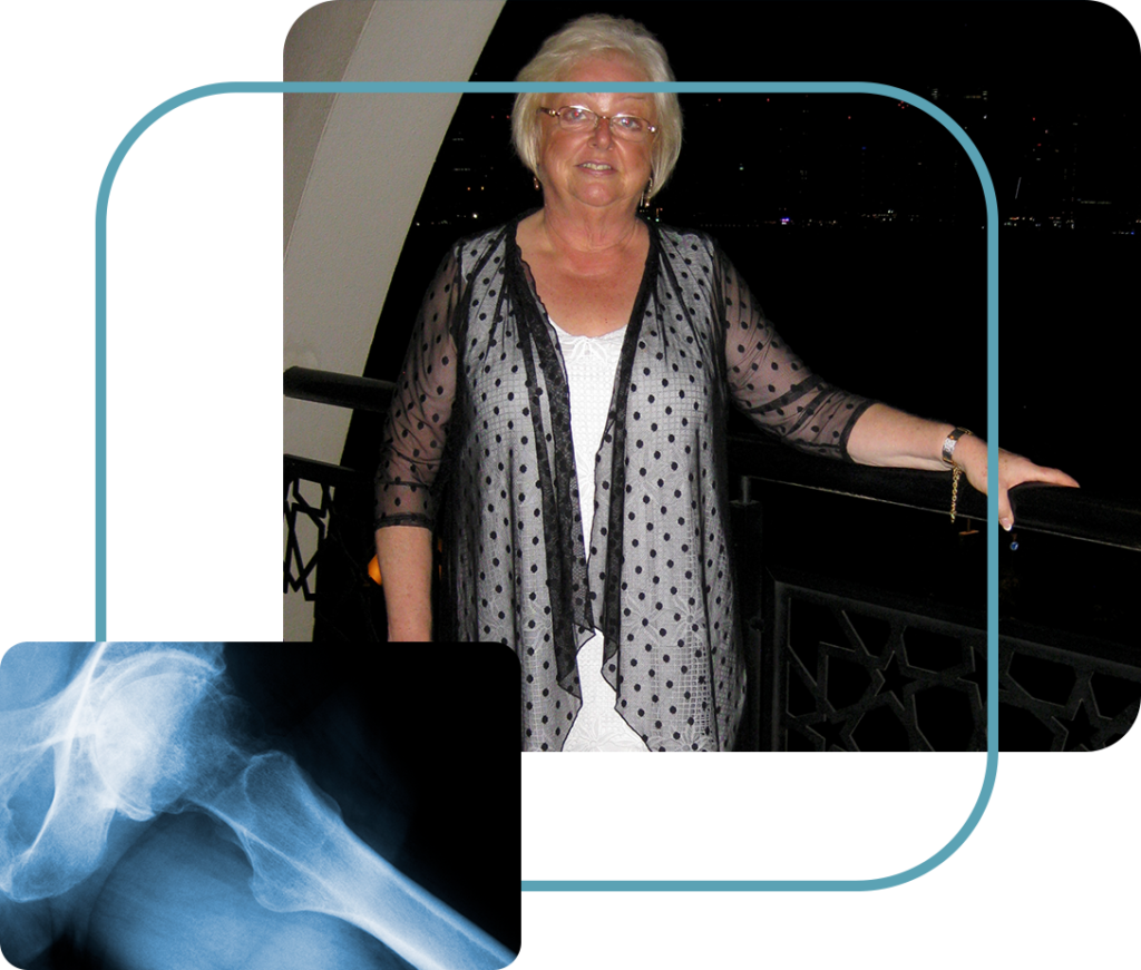 Christine's hip replacement case study