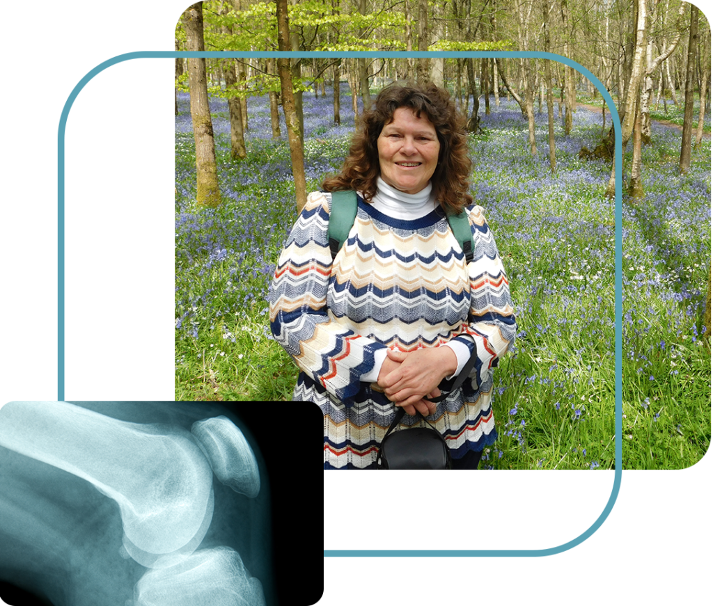 Louise's hip replacement case study