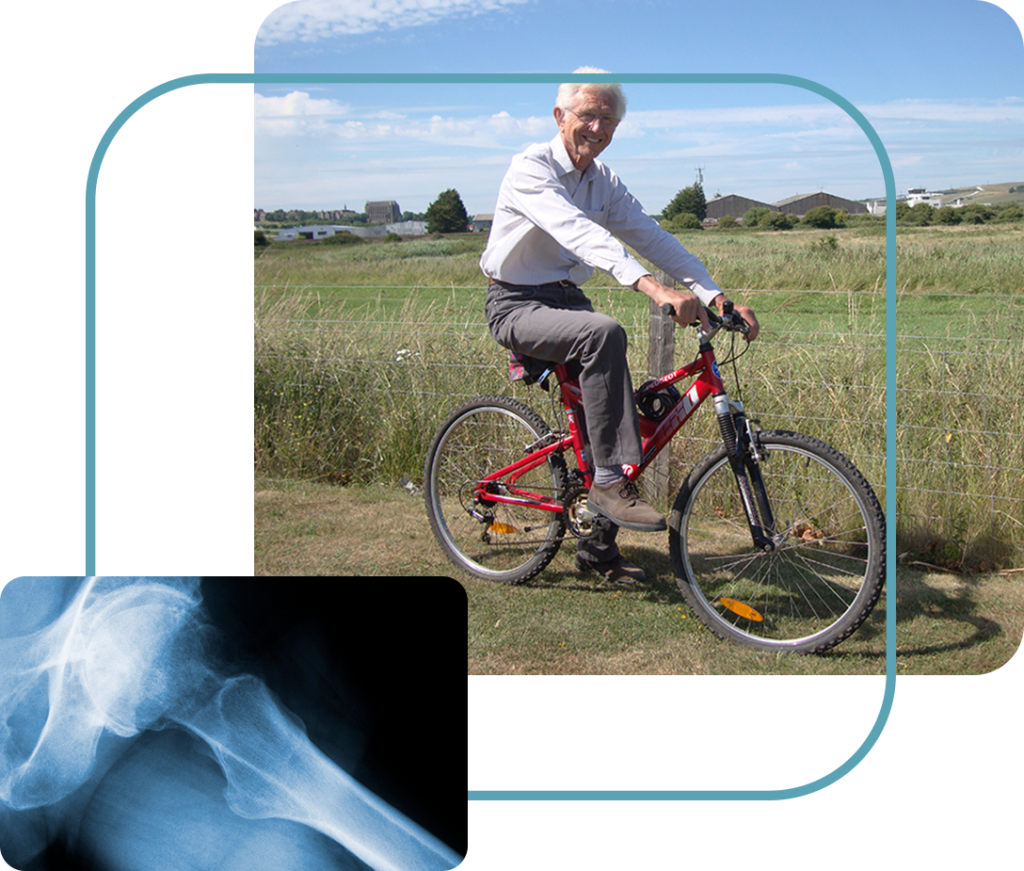 Mervyn's hip replacement case study