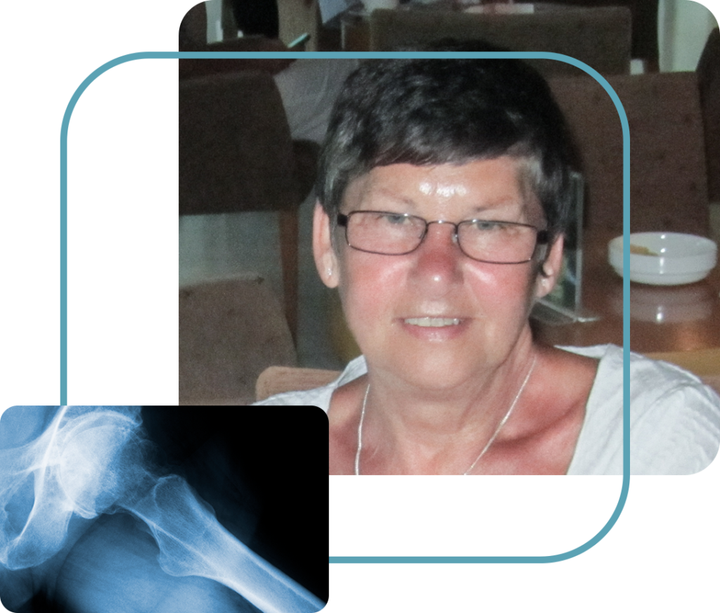 Patricia's hip replacement case study