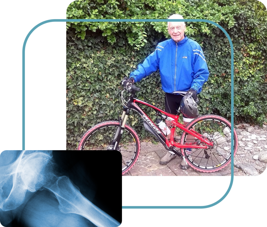 Peter's hip replacement case study