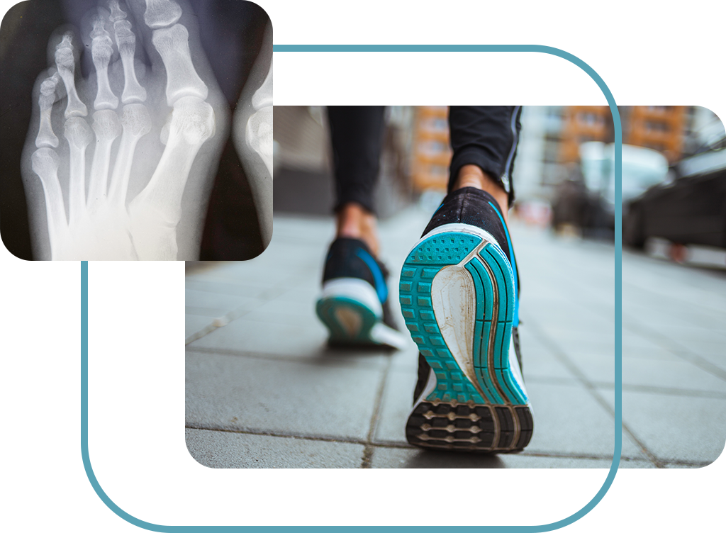 Orthopaedic treatments for foot problems